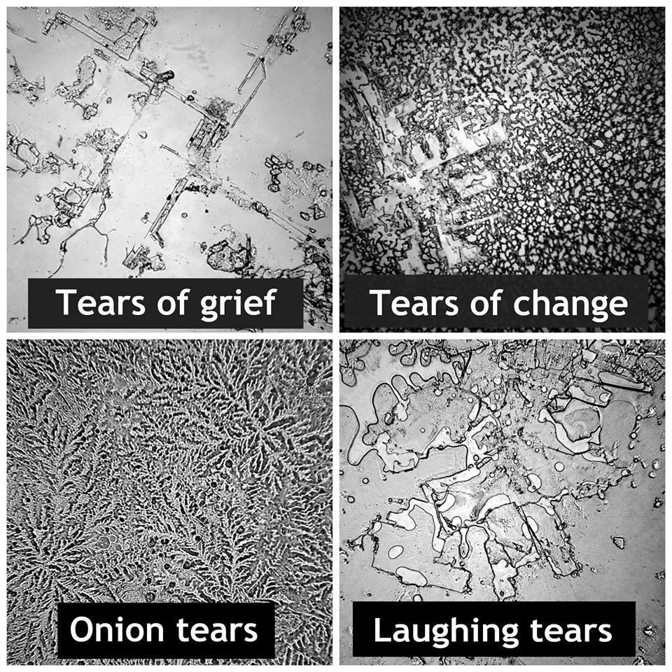 microscope-tears