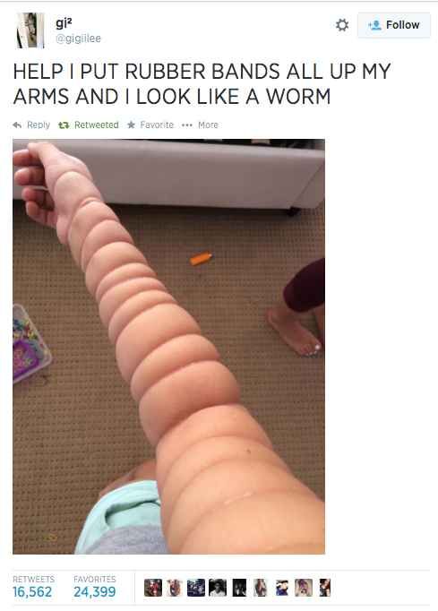 rubber bands arm
